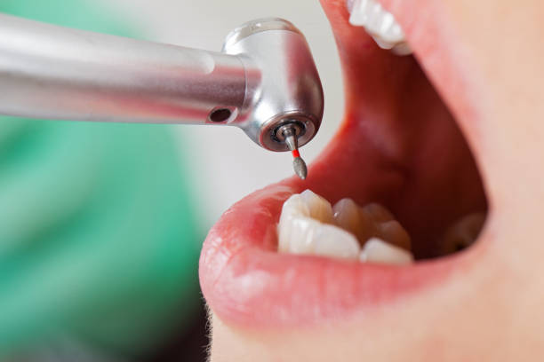 Best Emergency Dentist for Lost Fillings or Crowns in Streetsboro, OH